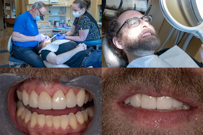 Dental Lab Work From McTech Dental Laboratory