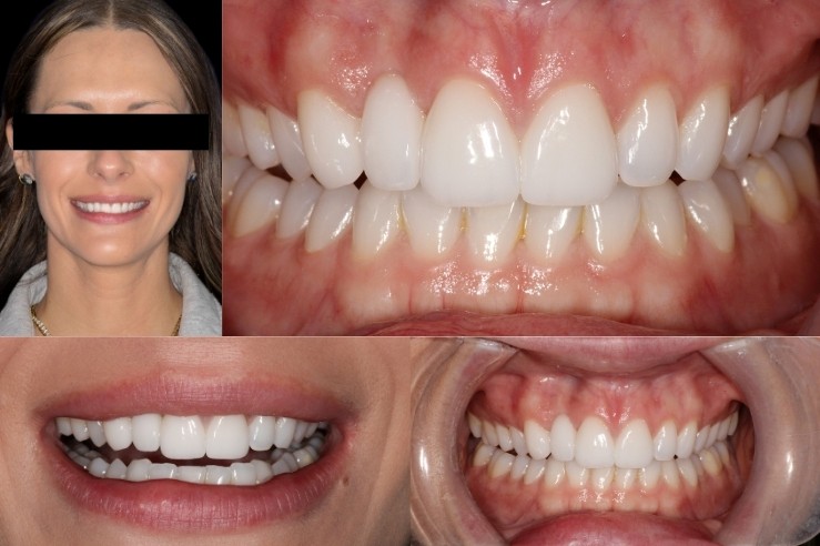 Dental review of McTech Dental Lab